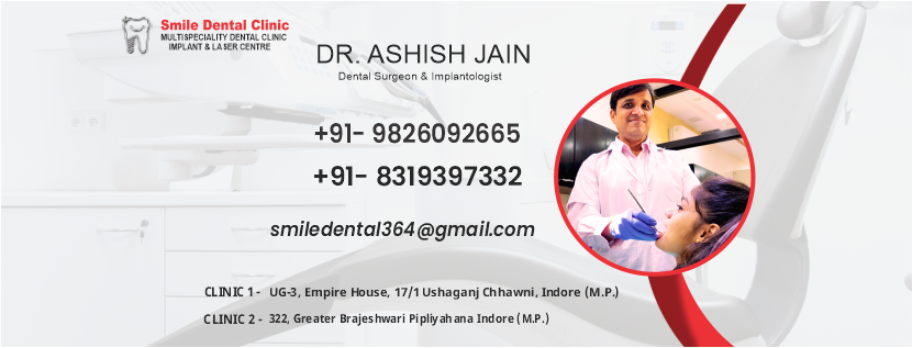 Smile Dental Clinic Indore | Dr Ashish Jain 